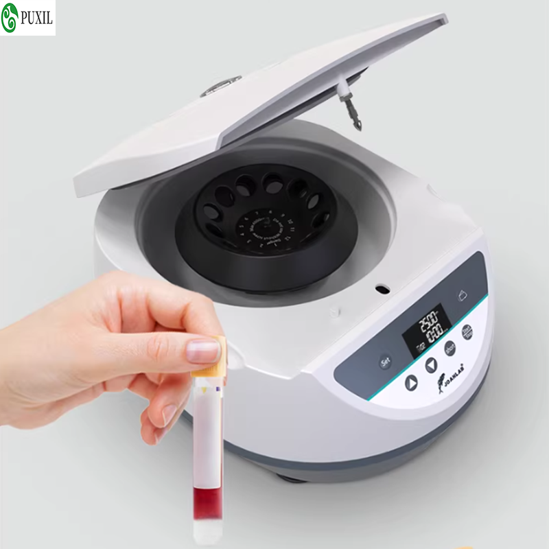 AB plasma centrifuge laborator - đánh giá và giá Blood Collection Tube