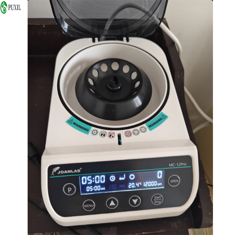 AB plasma centrifuge laborator - đánh giá và giá Blood Collection Tube